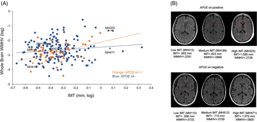 (A) Scatterplot of raw relationship between IMT (log) and WMHV (log) at the MsBrain visit by APOE ɛ4 status (orange = APOE ɛ4 positive, blue = APOE ɛ4 negative); (B) MRI scans of white matter hyperintensity volumes in representative women with low, medium, and high IMT by APOE ɛ4 status. Notes: WMHV values normalized by ICV; IMT represents mean IMT over eight locations of carotid artery; WMHV expressed as mm3/Intracranial volume (in mm3). APOE, apolipoprotein E; ICV, intracranial volume; IMT, intima media t